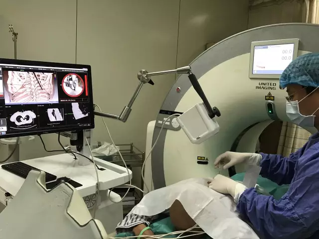 IQQA-Guide三維影像術(shù)中導(dǎo)航系統(tǒng)獲創(chuàng)新醫(yī)械特別審批，推動精準(zhǔn)醫(yī)療新發(fā)展